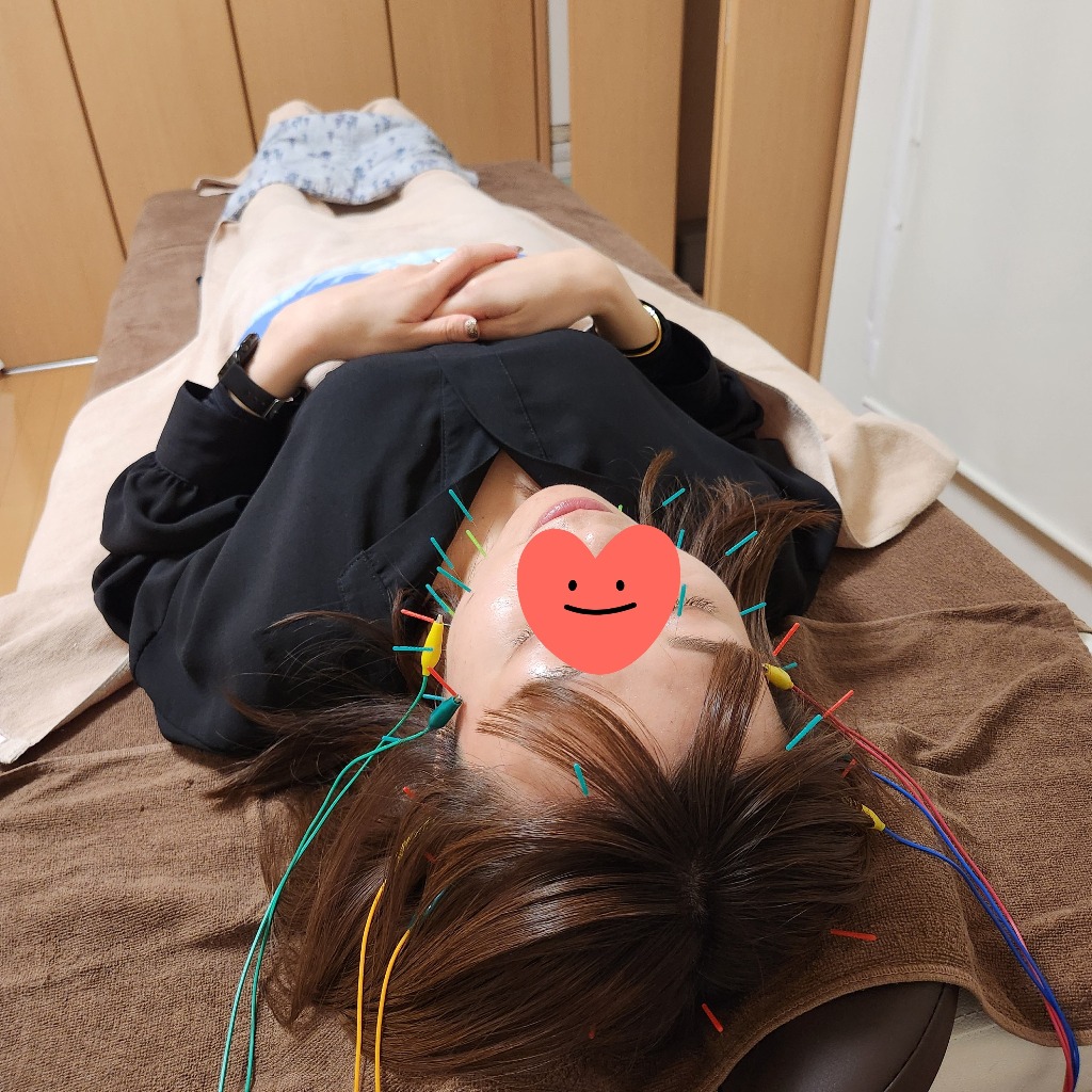 何度でも美容鍼(^▽^)