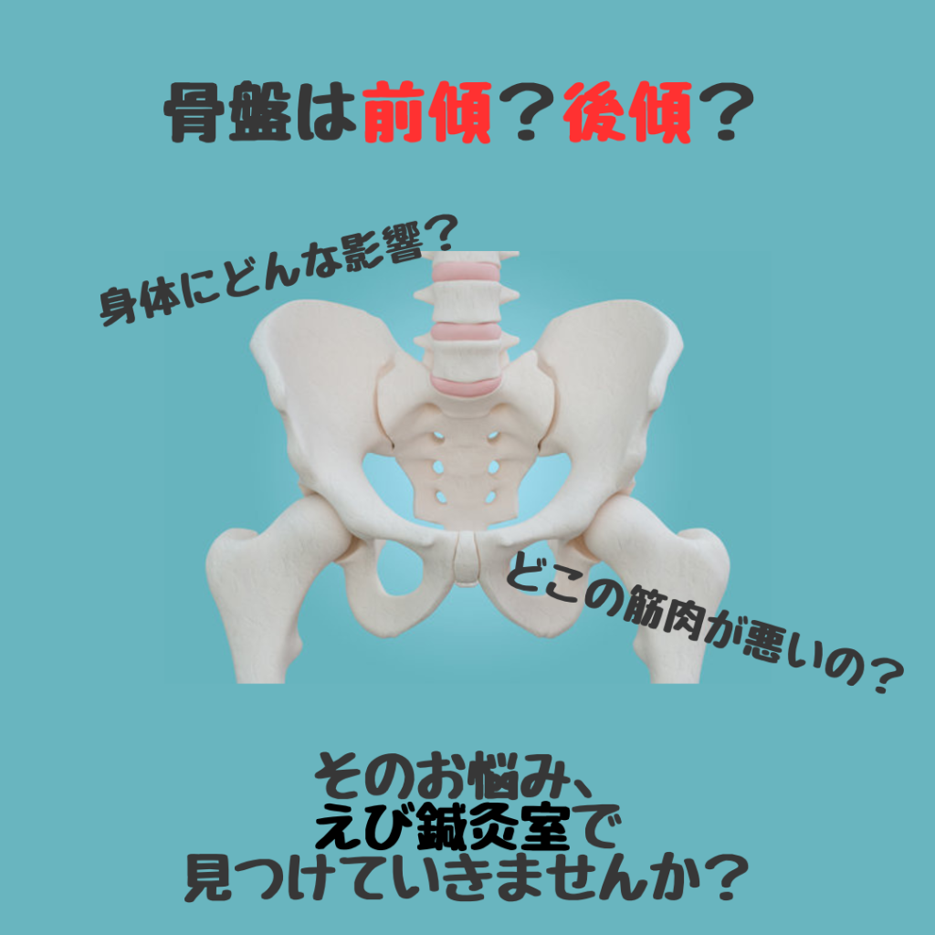 あなたの骨盤は前傾?後傾?