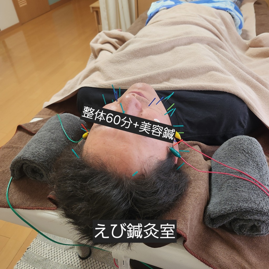 イケオジ計画に美容鍼!